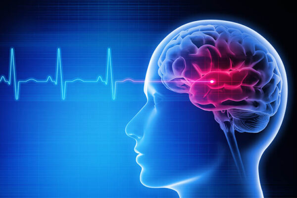 Особенности реабилитации после инсульта
