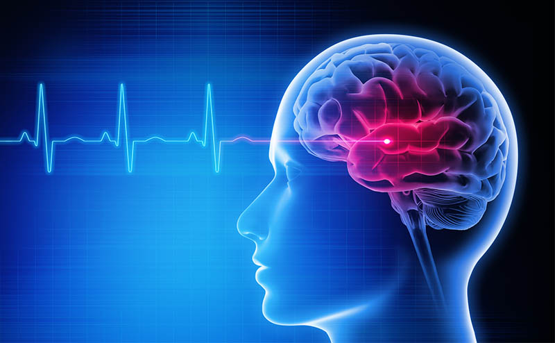 Особенности реабилитации после инсульта